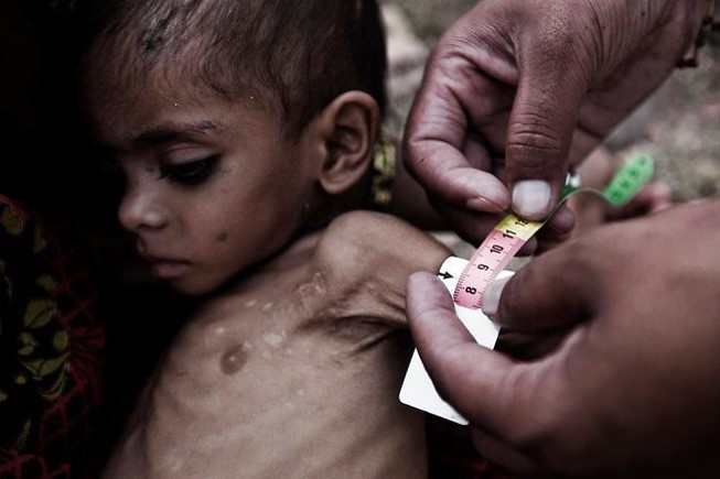 healthcare-projects-MARS